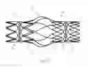 Fig. 21 - Protuberant aneurysm bridging device deployment method