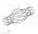 Fig. 26 - Protuberant aneurysm bridging device deployment method