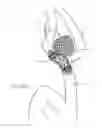 Fig. 29 - Protuberant aneurysm bridging device deployment method