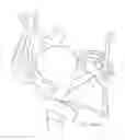Fig. 30 - Protuberant aneurysm bridging device deployment method