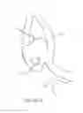 Fig. 36 - Protuberant aneurysm bridging device deployment method