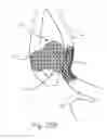 Fig. 37 - Protuberant aneurysm bridging device deployment method