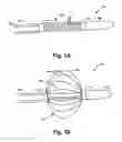 Fig. 02 - Anchoring guidewire and methods for use