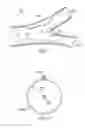 Fig. 02 - Deployment of Stents within Bifurcated Vessels