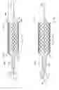 Fig. 09 - Deployment of Stents within Bifurcated Vessels