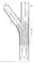 Fig. 16 - Deployment of Stents within Bifurcated Vessels