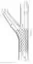 Fig. 17 - Deployment of Stents within Bifurcated Vessels
