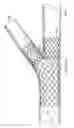 Fig. 19 - Deployment of Stents within Bifurcated Vessels