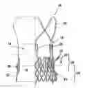 Fig. 01 - STENT SEALS AND METHODS FOR SEALING AN EXPANDABLE STENT