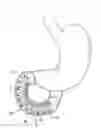 Fig. 01 - Duodenum sleeve for treating obesity