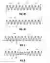 Fig. 03 - Duodenum sleeve for treating obesity