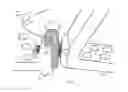 Fig. 04 - Dynamic foot plate
