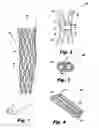 Fig. 02 - Orthopedic Cast