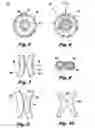 Fig. 03 - Orthopedic Cast