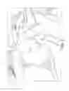 Fig. 02 - KIT AND METHOD FOR MAKING A SPLINT