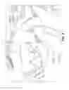Fig. 04 - KIT AND METHOD FOR MAKING A SPLINT