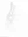 Fig. 03 - Ophthalmic surgical device for accessing tissue and for performing a capsulotomy