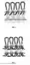 Fig. 02 - HIGH HYGROSCOPIC WOUND DRESSING AND PREPARATION METHOD AND USE THEREOF