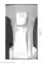 Fig. 24 - ABSORBENT ARTICLES HAVING SUBSTRATES HAVING FLOW CONTROL MATERIALS
