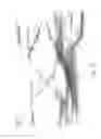 Fig. 29 - ABSORBENT ARTICLES HAVING SUBSTRATES HAVING FLOW CONTROL MATERIALS