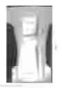 Fig. 24 - ABSORBENT ARTICLES HAVING SUBSTRATES HAVING ZONAL TREATMENTS