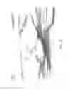 Fig. 29 - ABSORBENT ARTICLES HAVING SUBSTRATES HAVING ZONAL TREATMENTS