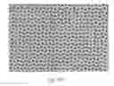 Fig. 49 - ABSORBENT ARTICLES HAVING SUBSTRATES HAVING ZONAL TREATMENTS