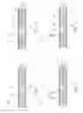 Fig. 11 - Absorbent Articles Having Zones