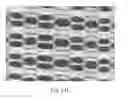 Fig. 47 - Absorbent Articles Having Zones