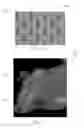 Fig. 76 - Absorbent Articles Having Zones