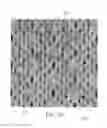 Fig. 98 - Absorbent Articles Having Zones