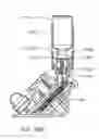 Fig. 265 - Method for fluid delivery