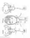 Fig. 02 - Oral mouthpiece and method for the use thereof