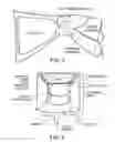 Fig. 04 - Methods of delivering pharmaceutical agents