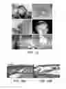 Fig. 09 - Methods of delivering pharmaceutical agents