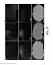 Fig. 10 - Methods of delivering pharmaceutical agents