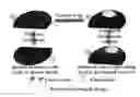 Fig. 01 - Cancer cell trap