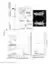 Fig. 02 - Cancer cell trap