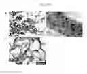 Fig. 12 - Cancer cell trap