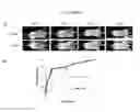 Fig. 27 - Cancer cell trap