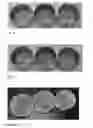 Fig. 04 - Dispersible Tablet
