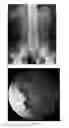 Fig. 02 - ENTERICALLY COATED CYSTEAMINE, CYSTAMINE AND DERIVATIVES THEREOF
