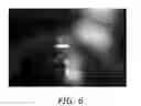 Fig. 06 - Intracameral sustained release therapeutic agent implants