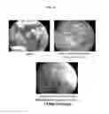 Fig. 09 - System for treating ear infections