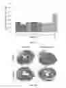 Fig. 06 - METHODS FOR TREATING CARDIAC CONDITIONS