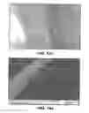 Fig. 12 - BIOADHESIVE FOR TISSUE REPAIR