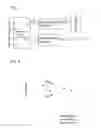 Fig. 04 - Method and device for collaborating ventilation using external diaphragm pacemaker and ventilator