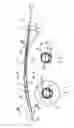 Fig. 02 - Jet ventilation catheter, in particular for ventilating a patient