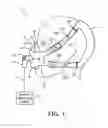 Fig. 02 - HEADGEAR AND PATIENT INTERFACE DEVICE EMPLOYING SAME