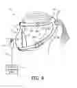 Fig. 08 - HEADGEAR AND PATIENT INTERFACE DEVICE EMPLOYING SAME